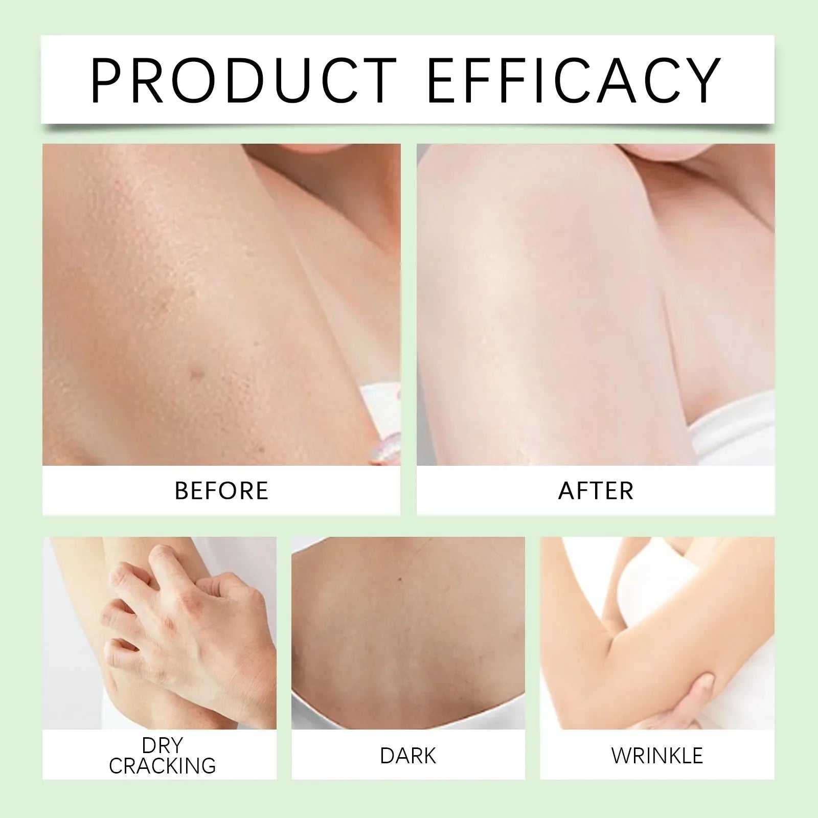 100ml/400ML Vaseline Body Lotion Whitening Moisturizer for Chicken Skin Treatment Brightening Skin Care Dual Size