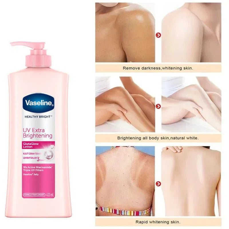 100ml/400ML Vaseline Body Lotion Whitening Moisturizer for Chicken Skin Treatment Brightening Skin Care Dual Size